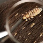 شپش موی سر نوعی انگل خارجی از خانواده Pediculidae است که به‌طور اختصاصی در موی انسان زندگی می‌کند. این انگل فقط خون انسان را مصرف می‌کند و بدون حضور میزبان، معمولاً بیش از ۲۴–۴۸ ساعت زنده نمی‌ماند. برخلاف تصور عمومی، وجود شپش ارتباطی با بی‌نظافتی، سطح اجتماعی، یا میزان شستشو ندارد و حتی در کودکان کاملاً تمیز هم دیده می‌شود.